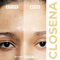 Closena Vitamin C Serum dropper close-up