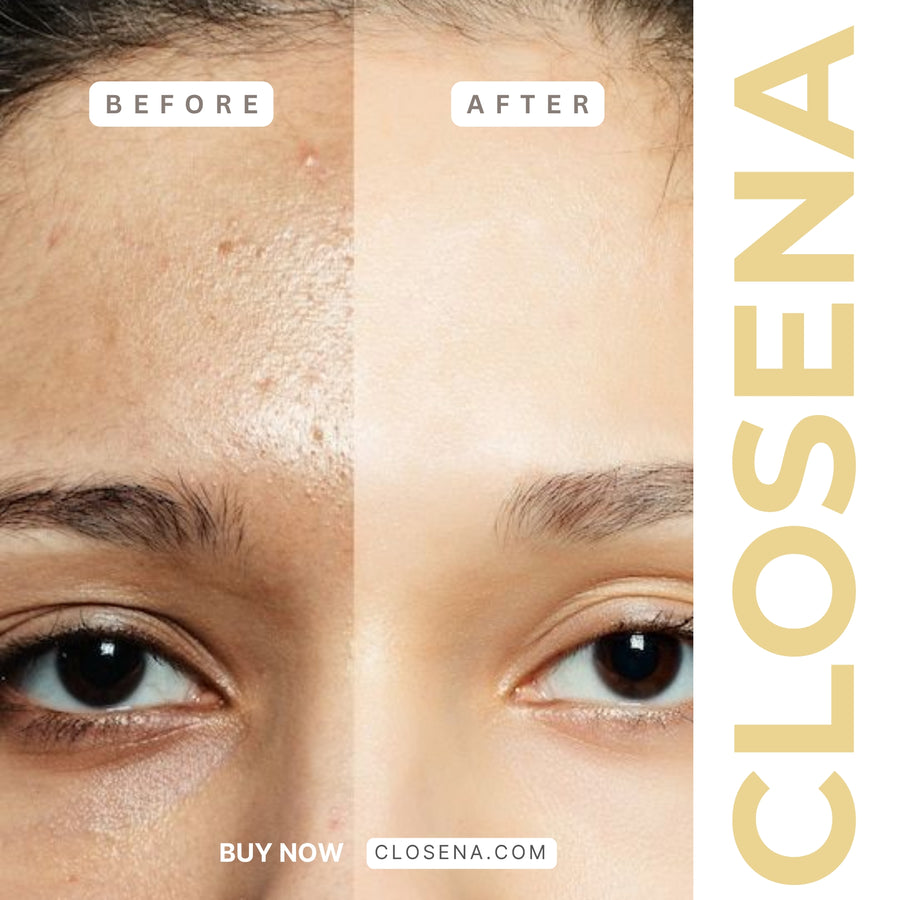 Closena Vitamin C Serum dropper close-up